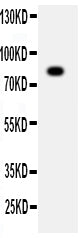 Anti-ADAM2 Antibody Picoband® Boster Bio