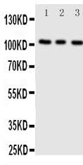 Anti-ADAMTS1 Antibody Picoband® Boster Bio