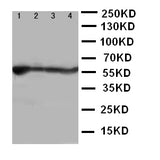 Anti-ALDH2 Antibody Picoband® Boster Bio