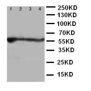 Anti-ALDH2 Antibody Picoband® Boster Bio