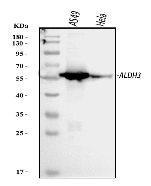 Anti-ALDH3A1 Antibody Picoband® Boster Bio