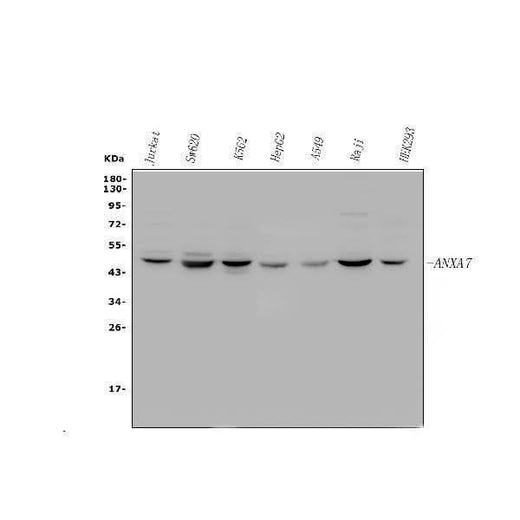 Anti-Annexin VII/ANXA7 Antibody Picoband® Boster Bio