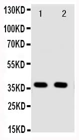 Anti-Annexin A10/ANXA10 Antibody Picoband® Boster Bio