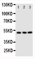 Anti-CXCR4 Antibody Picoband® Boster Bio