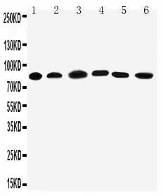Anti-PC1/3/PCSK1 Antibody Picoband® Boster Bio