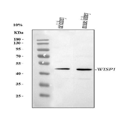 Anti-WISP1 Antibody Picoband® Boster Bio