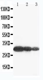 Anti-Aquaporin 6/AQP6 Antibody Picoband® Boster Bio