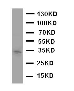 Anti-Aquaporin 10/AQP10 Antibody Picoband® Boster Bio