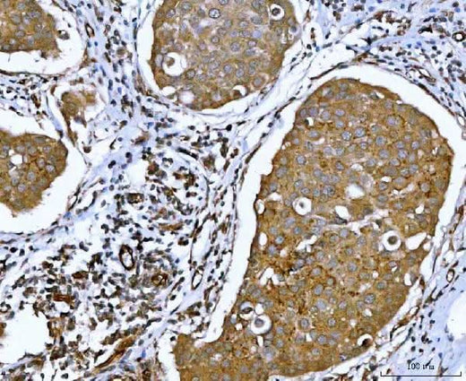 Anti-ATX2/ATXN2 Antibody Picoband® Boster Bio