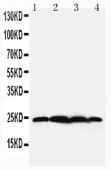 Anti-BAG2 Antibody Picoband® Boster Bio