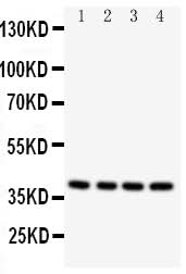 Anti-Caspase-12/CASP12 Antibody Picoband® Boster Bio