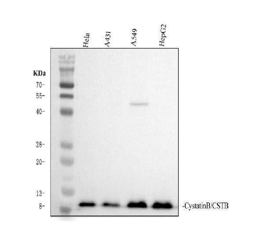 Anti-Stefin B/CSTB Antibody Picoband® Boster Bio