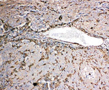 Anti-Gelsolin/GSN Antibody Picoband® Boster Bio