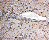Anti-Gelsolin/GSN Antibody Picoband® Boster Bio