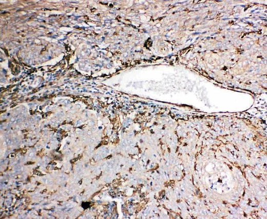 Anti-Gelsolin/GSN Antibody Picoband® Boster Bio
