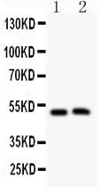 Anti-Aquaporin 0/MIP Antibody Picoband® Boster Bio