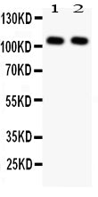 Anti-NFkB/NFKB1 p105/p50 Antibody Picoband® Boster Bio