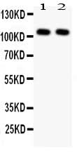 Anti-NFkB/NFKB1 p105/p50 Antibody Picoband® Boster Bio