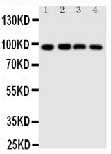 Anti-SIDT1 Antibody Picoband® Boster Bio