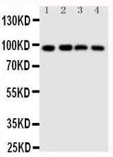 Anti-SIDT1 Antibody Picoband® Boster Bio