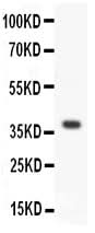 Anti-Protein Wnt-3a Wnt3a Antibody Picoband® Boster Bio