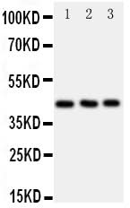 Anti-C-C chemokine receptor type 9 CCR9 Antibody Picoband® Boster Bio