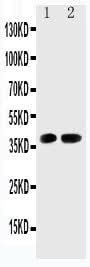 Anti-Cyclin-dependent kinase 6 Cdk6 Antibody Picoband® Boster Bio