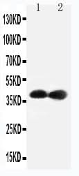 Anti-Cyclin-dependent kinase 7 Cdk7 Antibody Picoband® Boster Bio