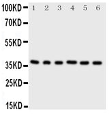 Anti-Cyclin-dependent kinase 7 Cdk7 Antibody Picoband® Boster Bio