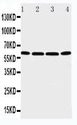 Anti-P2X6/P2RX6 Antibody Picoband® Boster Bio