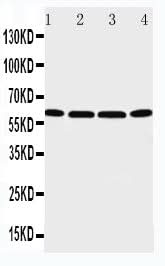 Anti-P2X6/P2RX6 Antibody Picoband® Boster Bio