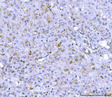 Anti-PCSK9 Antibody Picoband® Boster Bio