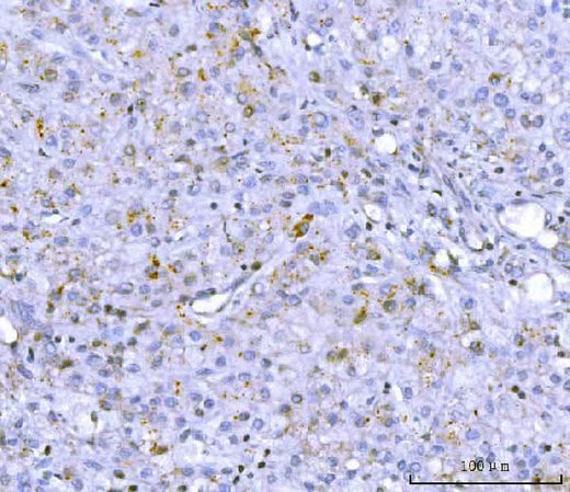 Anti-PCSK9 Antibody Picoband® Boster Bio