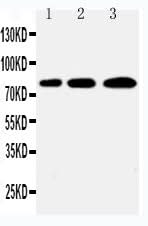 Anti-PLK2 Antibody Picoband® Boster Bio