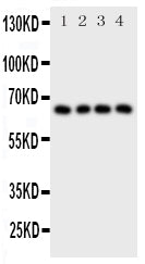 Anti-Parathyroid Hormone Receptor 1/PTH1R Antibody Picoband® Boster Bio