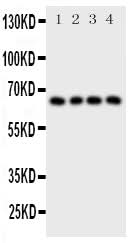 Anti-Parathyroid Hormone Receptor 1/PTH1R Antibody Picoband® Boster Bio