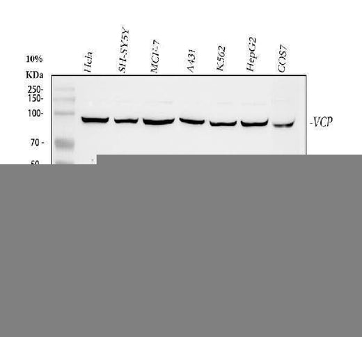 Anti-VCP Antibody Picoband® Boster Bio