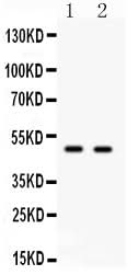 Anti-Transcription factor E2F3 E2F3 Antibody Picoband® Boster Bio