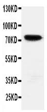 Anti-HIF3/HIF3A Antibody Picoband® Boster Bio