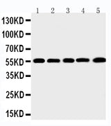 Anti-Macrophage metalloelastase MMP12 Antibody Picoband® Boster Bio