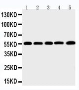 Anti-Macrophage metalloelastase MMP12 Antibody Picoband® Boster Bio