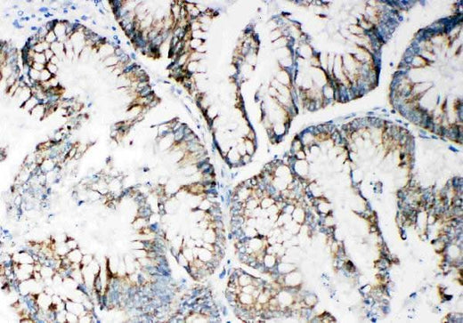 Anti-Matrix metalloproteinase-14 MMP14 Antibody Picoband® Boster Bio