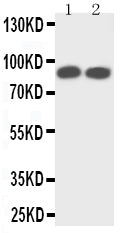 Anti-TrkA/NTRK1 Antibody Picoband® Boster Bio