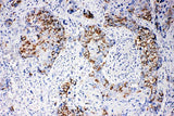 Anti-beta Arrestin 1/ARRB1 Antibody Picoband® Boster Bio