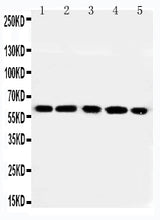 Anti-RGS14 Antibody Picoband® Boster Bio