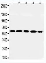 Anti-RGS14 Antibody Picoband® Boster Bio