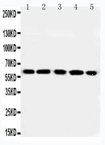 Anti-RGS14 Antibody Picoband® Boster Bio