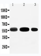Anti-EAAT3/SLC1A1 Antibody Picoband® Boster Bio