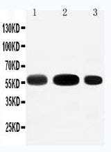 Anti-EAAT3/SLC1A1 Antibody Picoband® Boster Bio