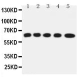 Anti-Solute carrier family 22 member 5/SLC22A5 Antibody Picoband® Boster Bio